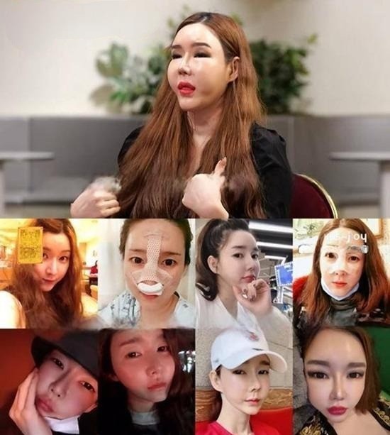 A chia sẻ hình ảnh về những thay đổi của mình trong suốt những năm qua. Ảnh: Nate