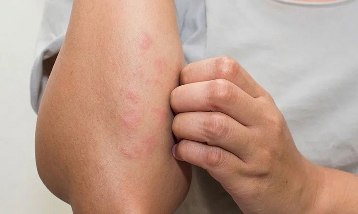 7 triệu chứng âm thầm cảnh báo suy thận 1 7 trieu chung am tham canh bao suy than