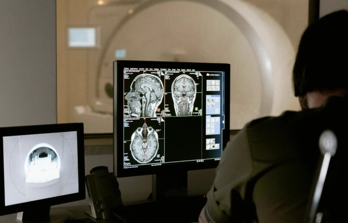 Chụp cộng hưởng từ não cho bệnh nhân. Ảnh: Theo Pexels