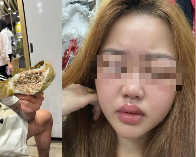 Đặc sản bánh trứng kiến: Tại sao nhiều người dị ứng, sưng phù mặt mũi? - Ảnh 1. bánh trứng kiến - Ảnh 1.