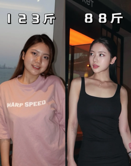 Giảm 18 kg sau 3 tháng nhờ ăn theo quy tắc 2:1:1 1 Susann thời điểm gần 62 kg và sau khi giảm còn 44 kg (cao 1,6 m).