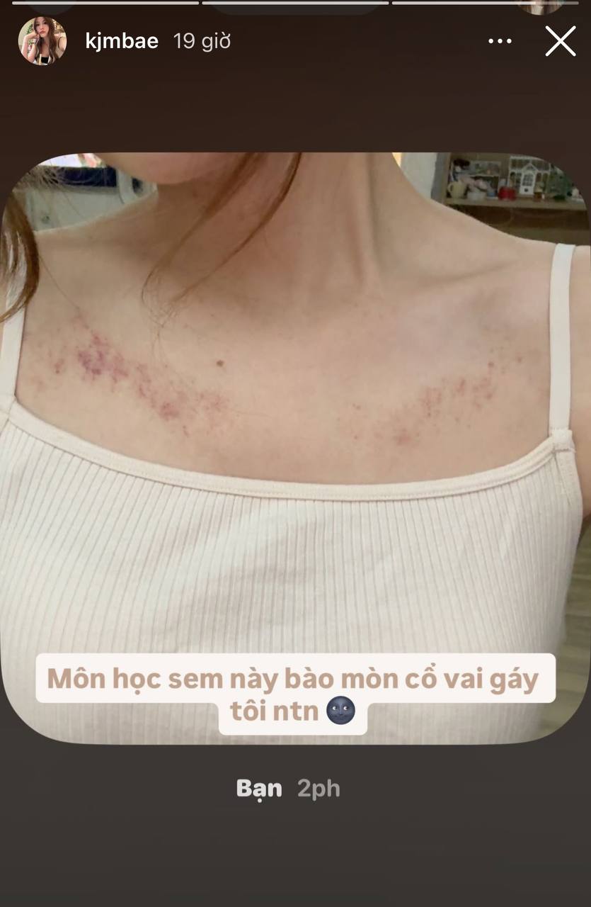 HIEUTHUHAI và Tăng Mỹ Hàn chuyển địa điểm hẹn hò, lần này là trị liệu xương khớp- Ảnh 2.