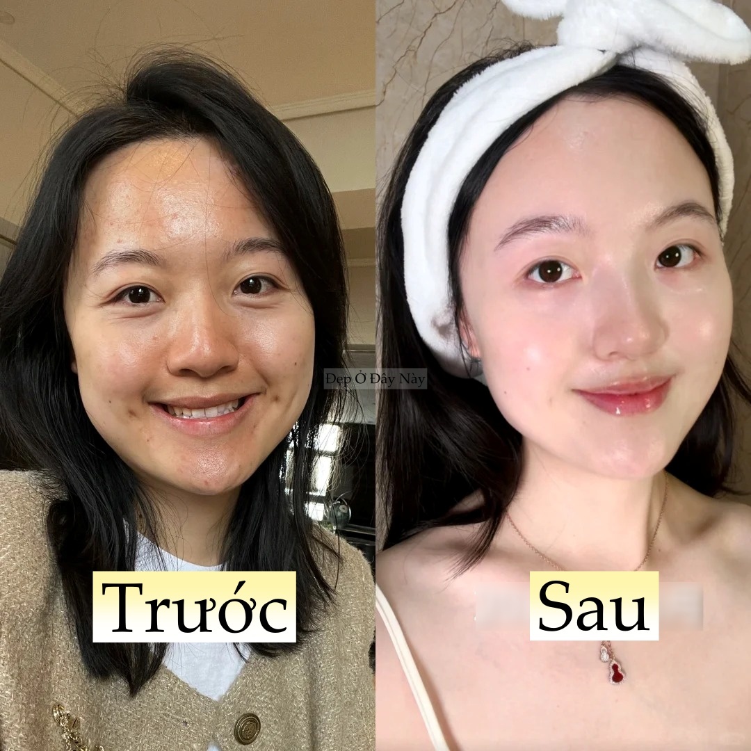 Làm 5 việc này khi đi ngủ, làn da của tôi như 