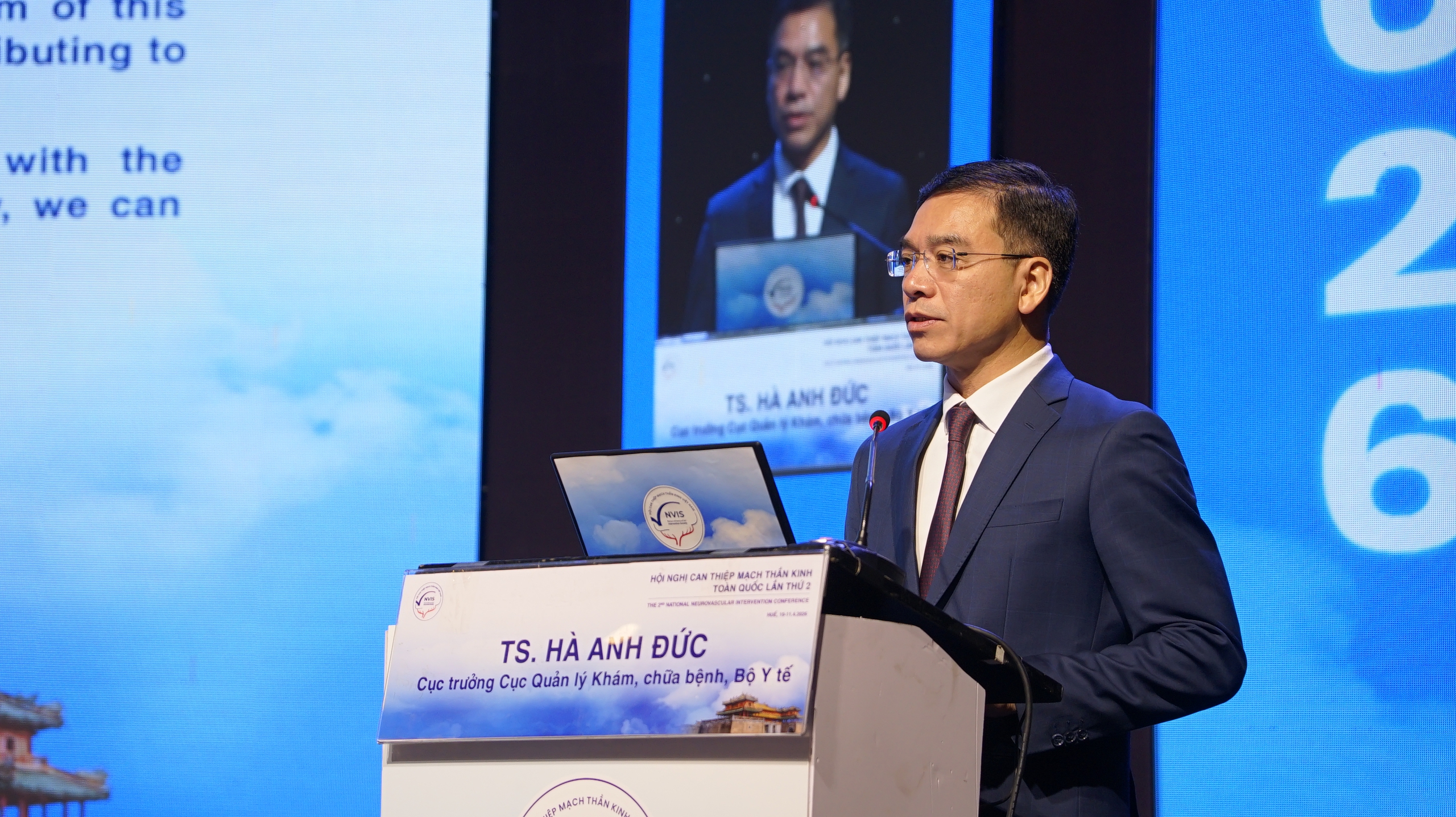 Mỗi năm thế giới có hơn 12,2 triệu ca đột quỵ, Việt Nam hơn 200.000 ca 1 Mỗi năm thế giới có hơn 12,2 triệu ca đột quỵ, Việt Nam hơn 200.000 ca - Ảnh 1.