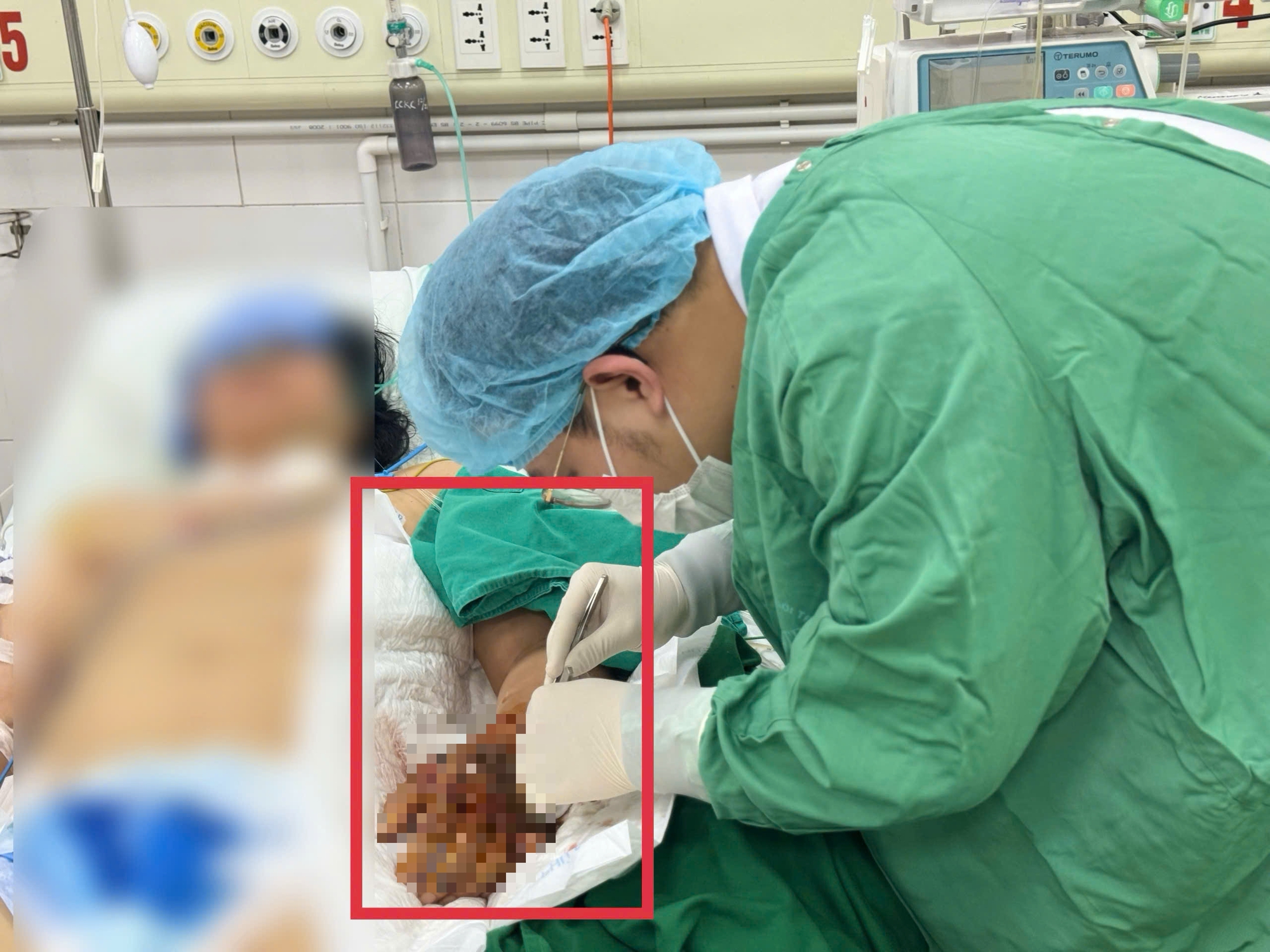 sốc nhiễm khuẩn - Ảnh 1.