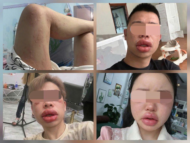 Những hình ảnh "dở khóc dở cười" đang trở thành trào lưu trên mạng xã hội. Ảnh chụp màn hình.