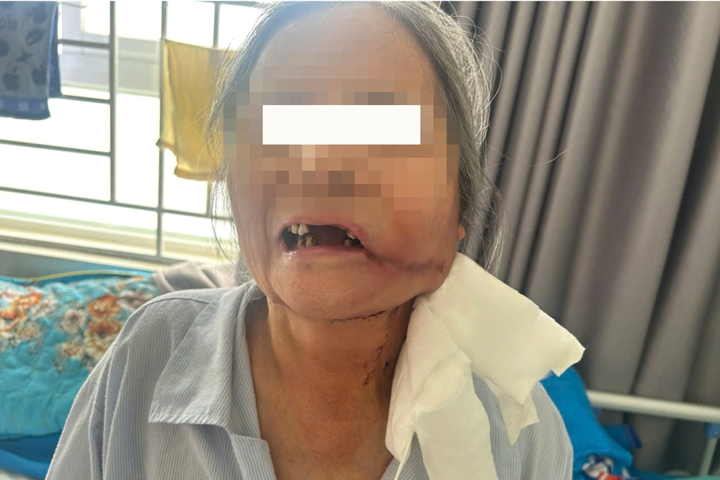 TPHCM: Cấp cứu cháu bé có khối u não to gấp ba lần chỉ trong 3 tháng - 3