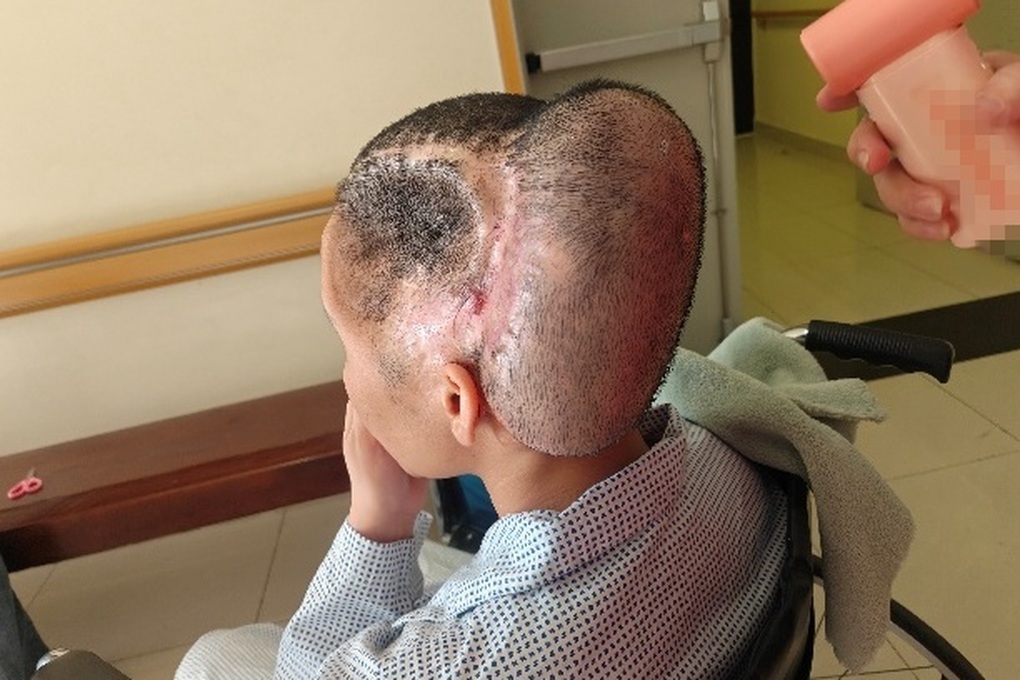 TPHCM: Cô gái đột qụy, biến dạng vùng đầu nặng nề sau phẫu thuật thẩm mỹ - 1