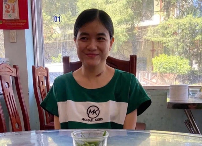 Vụ dùng xyanua đầu độc người tình rồi lao xe xuống đèo Bảo Lộc tạo hiện trường giả: Trần Nguyễn Thu Trang lĩnh 30 năm tù- Ảnh 2.