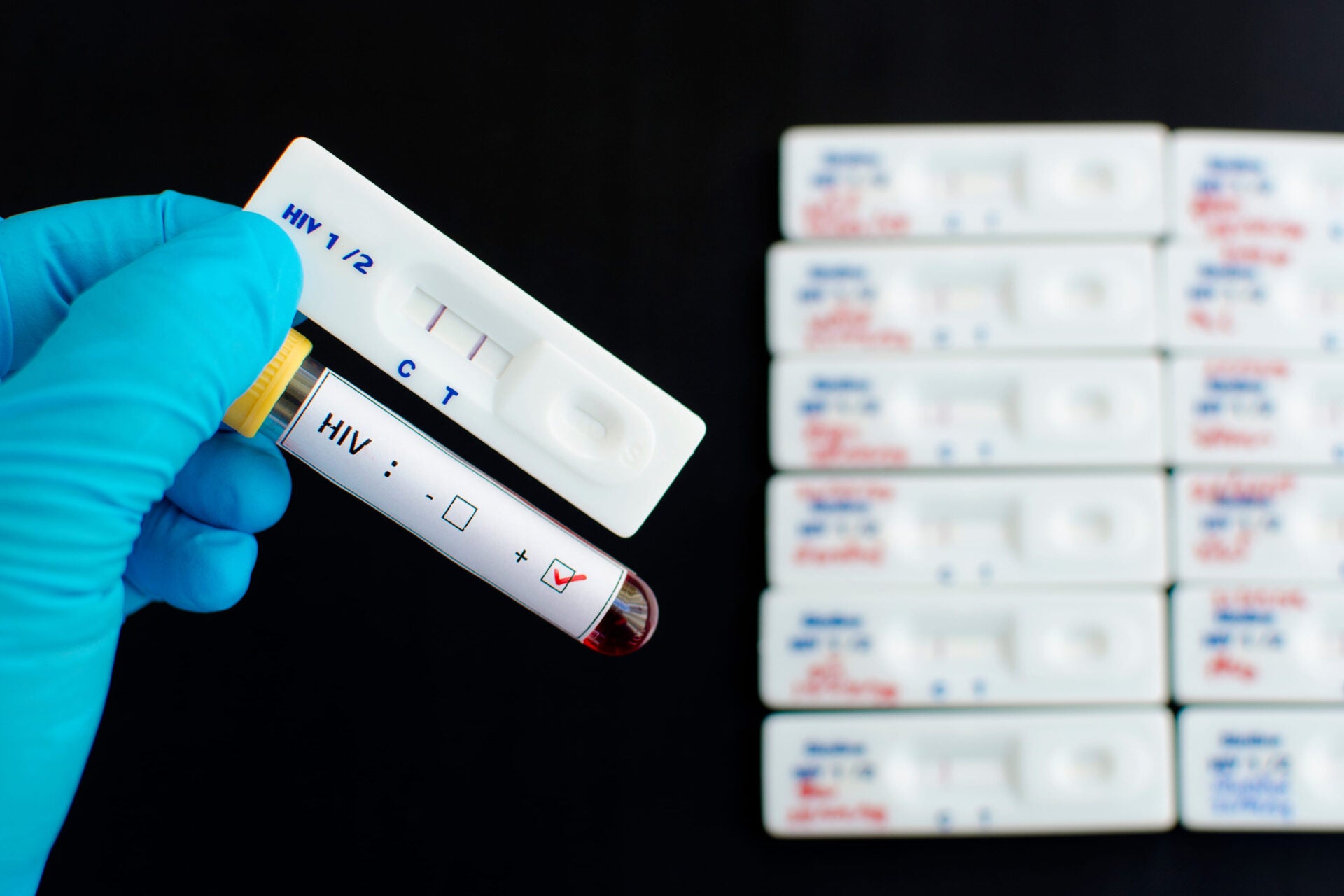 Vợ bị nhiễm HIV sau khi chồng đi 